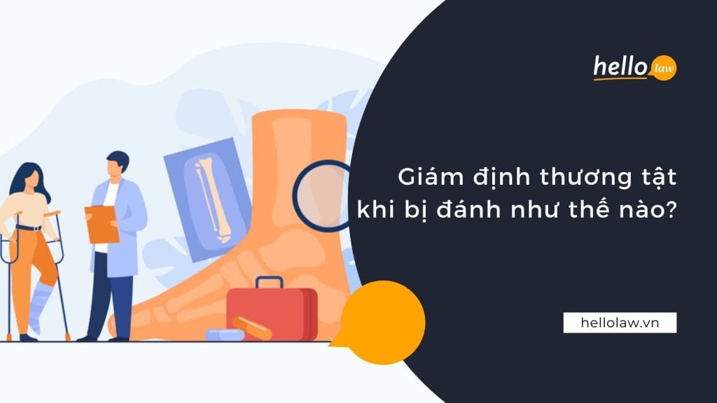 Giám định thương tật